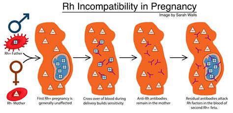 Why Do Some Pregnant Women Type as Both Rh。